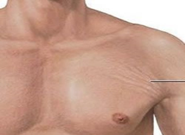 Essential Oils For Stretch Marks